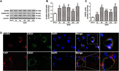 ErbB4 Preserves Blood-Brain Barrier Integrity via the YAP/PIK3CB Pathway After Subarachnoid Hemorrhage in Rats